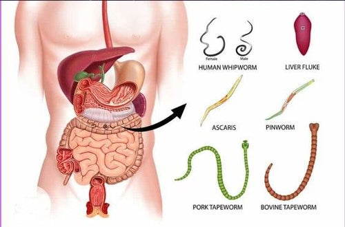 How To Get Rid of Intestinal Parasites
