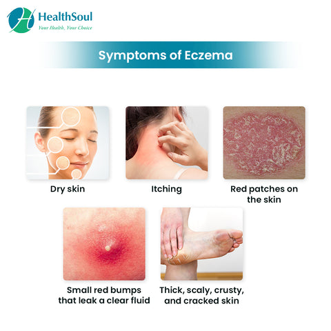 Eczema Consultation  Scan & Diet Plan