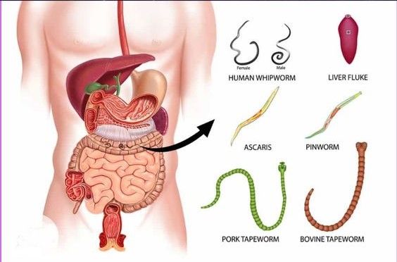 How To Get Rid of Intestinal Parasites