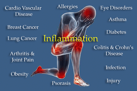 Arthritis/ Inflammation Response Consultation/scan