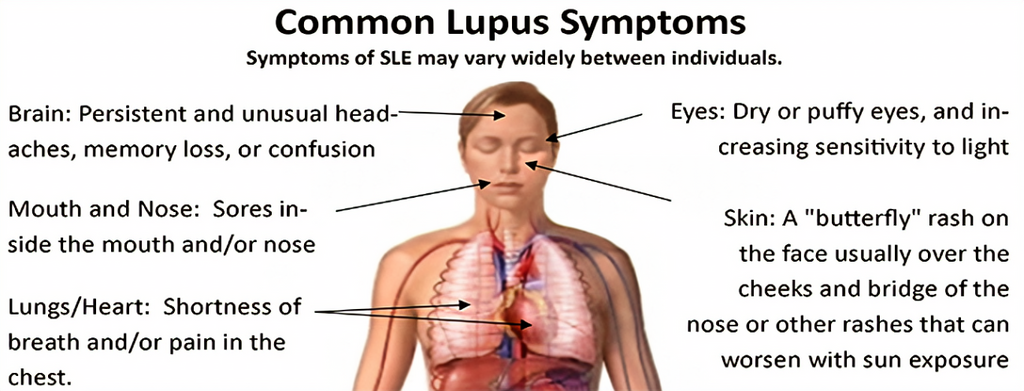 Lupus consultation Scan