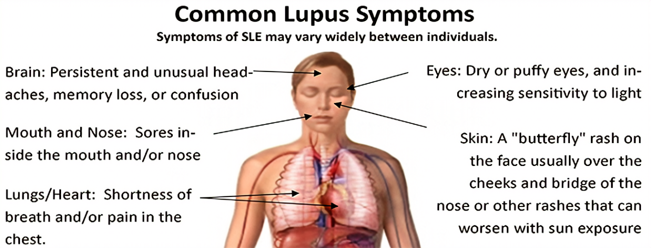 Lupus consultation Scan