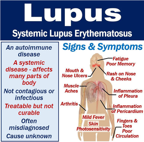 Lupus consultation Scan